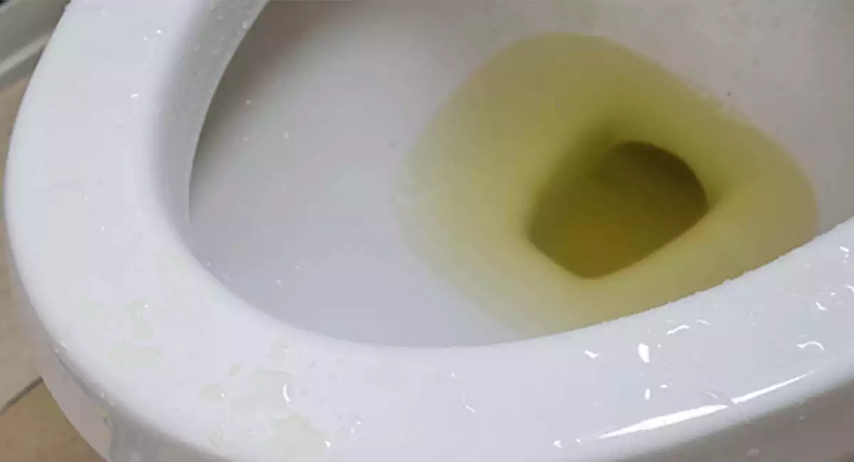 dirty toilet
